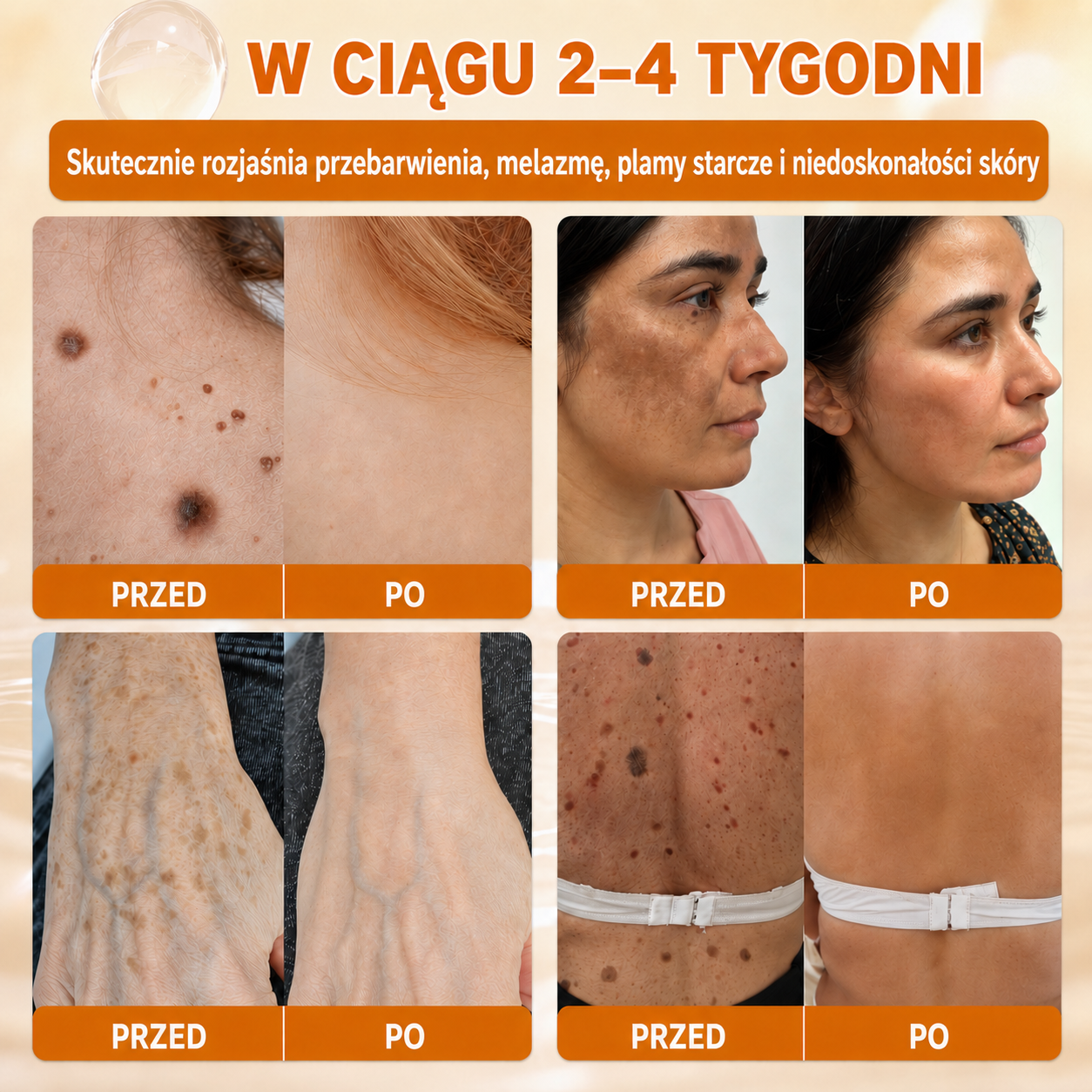 波兰🔥🔥𝐎𝐟𝐢𝐜𝐢á𝐥𝐧í 𝐨𝐛𝐜𝐡𝐨𝐝 • 𝐕𝐲𝐫𝐨𝐛𝐞𝐧𝐨 𝐯 Č𝐞𝐬𝐤é 𝐫𝐞𝐩𝐮𝐛𝐥𝐢𝐜𝐞 👑𝗗𝐨𝐫𝗺𝐨𝐫𝗻𝗮® 𝗩č𝗲𝗹í 𝗷𝗲𝗱 𝗞𝗼𝗺𝗽𝗹𝗲𝘅𝗻í 𝗸𝗿é𝗺 🌟𝐏𝐎𝐒𝐋𝐄𝐃𝐍Í 𝐃𝐄𝐍 – 𝟖𝟎 % 𝐒𝐋𝐄𝐕𝐀（副本）（副本）（副本）（副本）