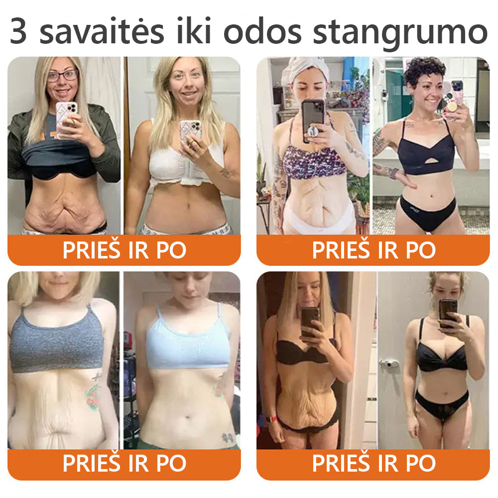 𝐏𝐚𝐠𝐚𝐦𝐢𝐧𝐭𝐚 𝐢𝐫 𝐢š𝐬𝐢ų𝐬𝐭𝐚 𝐢š 𝐋𝐢𝐞𝐭𝐮𝐯𝐨𝐬🍃𝐃𝐨𝐫𝐦𝐨𝗿𝗻𝗮® 𝐁𝐢č𝐢ų 𝐧𝐮𝐨𝐝𝐚𝐢 𝐕𝐢𝐬𝐚𝐩𝐮𝐬𝐢š𝐤𝐚𝐬 𝐤𝐫𝐞𝐦𝐚𝐬🌟𝑷𝑨𝑺𝑲𝑼𝑻𝑰𝑵Ę 𝑫𝑰𝑬𝑵Ą 80% 𝑵𝑼𝑶𝑳𝑨𝑰𝑫𝑨🔥🔥