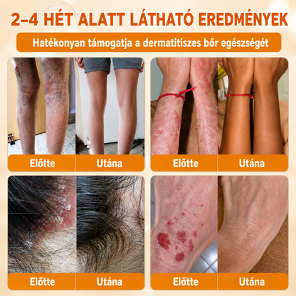 匈牙利🔥🔥𝐎𝐟𝐢𝐜𝐢á𝐥𝐧í 𝐨𝐛𝐜𝐡𝐨𝐝 • 𝐕𝐲𝐫𝐨𝐛𝐞𝐧𝐨 𝐯 Č𝐞𝐬𝐤é 𝐫𝐞𝐩𝐮𝐛𝐥𝐢𝐜𝐞 👑𝗗𝐨𝐫𝗺𝐨𝐫𝗻𝗮® 𝗩č𝗲𝗹í 𝗷𝗲𝗱 𝗞𝗼𝗺𝗽𝗹𝗲𝘅𝗻í 𝗸𝗿é𝗺 🌟𝐏𝐎𝐒𝐋𝐄𝐃𝐍Í 𝐃𝐄𝐍 – 𝟖𝟎 % 𝐒𝐋𝐄𝐕𝐀（副本）（副本）