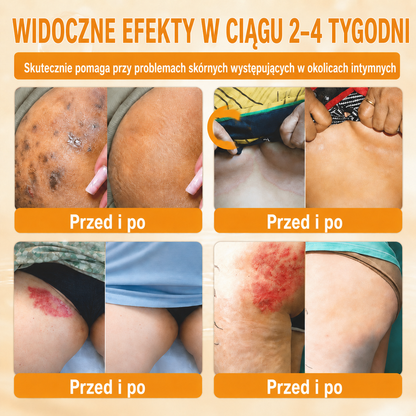 波兰🔥🔥𝐎𝐟𝐢𝐜𝐢á𝐥𝐧í 𝐨𝐛𝐜𝐡𝐨𝐝 • 𝐕𝐲𝐫𝐨𝐛𝐞𝐧𝐨 𝐯 Č𝐞𝐬𝐤é 𝐫𝐞𝐩𝐮𝐛𝐥𝐢𝐜𝐞 👑𝗗𝐨𝐫𝗺𝐨𝐫𝗻𝗮® 𝗩č𝗲𝗹í 𝗷𝗲𝗱 𝗞𝗼𝗺𝗽𝗹𝗲𝘅𝗻í 𝗸𝗿é𝗺 🌟𝐏𝐎𝐒𝐋𝐄𝐃𝐍Í 𝐃𝐄𝐍 – 𝟖𝟎 % 𝐒𝐋𝐄𝐕𝐀（副本）（副本）（副本）（副本）