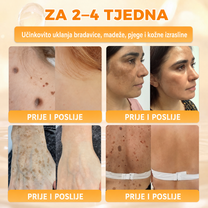🔥🔥𝐒𝐥𝐮ž𝐛𝐞𝐧𝐚 𝐭𝐫𝐠𝐨𝐯𝐢𝐧𝐚 • 𝐏𝐫𝐨𝐢𝐳𝐯𝐞𝐝𝐞𝐧𝐨 𝐮 𝐇𝐫𝐯𝐚𝐭𝐬𝐤𝐨𝐣 👑𝗗𝗼𝗿𝗺𝗼𝗿𝗻𝗮® 𝗣č𝗲𝗹𝗶𝗻𝗷𝗶 𝗼𝘁𝗿𝗼𝘃 𝗖𝗷𝗲𝗹𝗼𝘃𝗶𝘁𝗮 𝗸𝗿𝗲𝗺𝗮🌟𝐏𝐎𝐒𝐋𝐉𝐄𝐃𝐍𝐉𝐈 𝐃𝐀𝐍 – 𝟖𝟎 % 𝐏𝐎𝐏𝐔𝐒𝐓𝐀