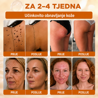 🔥🔥𝐒𝐥𝐮ž𝐛𝐞𝐧𝐚 𝐭𝐫𝐠𝐨𝐯𝐢𝐧𝐚 • 𝐏𝐫𝐨𝐢𝐳𝐯𝐞𝐝𝐞𝐧𝐨 𝐮 𝐇𝐫𝐯𝐚𝐭𝐬𝐤𝐨𝐣 👑𝗗𝗼𝗿𝗺𝗼𝗿𝗻𝗮® 𝗣č𝗲𝗹𝗶𝗻𝗷𝗶 𝗼𝘁𝗿𝗼𝘃 𝗖𝗷𝗲𝗹𝗼𝘃𝗶𝘁𝗮 𝗸𝗿𝗲𝗺𝗮🌟𝐏𝐎𝐒𝐋𝐉𝐄𝐃𝐍𝐉𝐈 𝐃𝐀𝐍 – 𝟖𝟎 % 𝐏𝐎𝐏𝐔𝐒𝐓𝐀