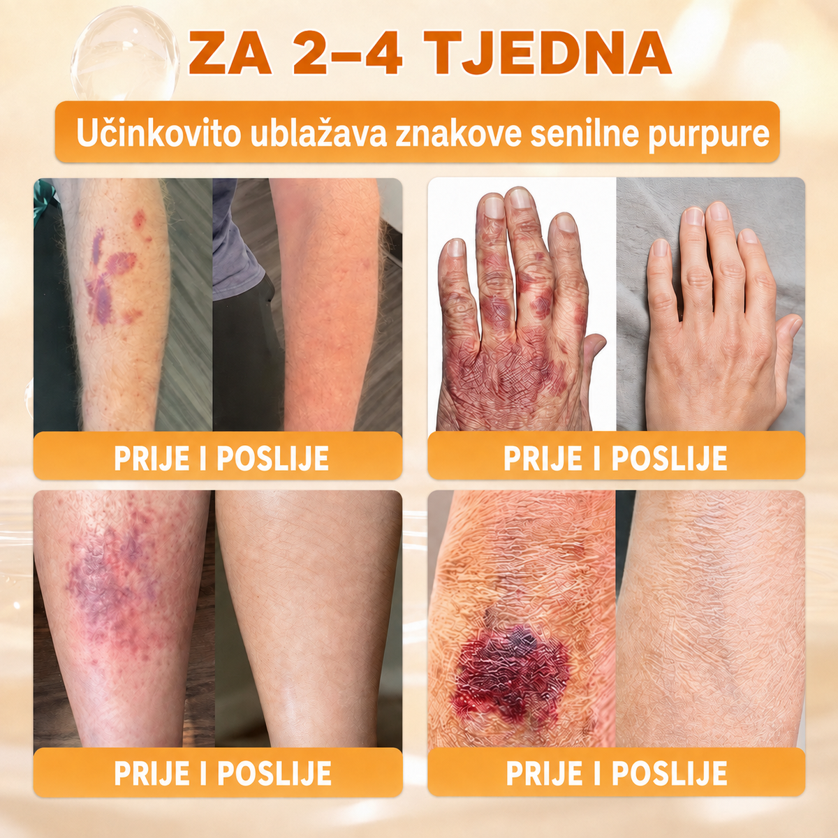 🔥🔥𝐒𝐥𝐮ž𝐛𝐞𝐧𝐚 𝐭𝐫𝐠𝐨𝐯𝐢𝐧𝐚 • 𝐏𝐫𝐨𝐢𝐳𝐯𝐞𝐝𝐞𝐧𝐨 𝐮 𝐇𝐫𝐯𝐚𝐭𝐬𝐤𝐨𝐣 👑𝗗𝗼𝗿𝗺𝗼𝗿𝗻𝗮® 𝗣č𝗲𝗹𝗶𝗻𝗷𝗶 𝗼𝘁𝗿𝗼𝘃 𝗖𝗷𝗲𝗹𝗼𝘃𝗶𝘁𝗮 𝗸𝗿𝗲𝗺𝗮🌟𝐏𝐎𝐒𝐋𝐉𝐄𝐃𝐍𝐉𝐈 𝐃𝐀𝐍 – 𝟖𝟎 % 𝐏𝐎𝐏𝐔𝐒𝐓𝐀