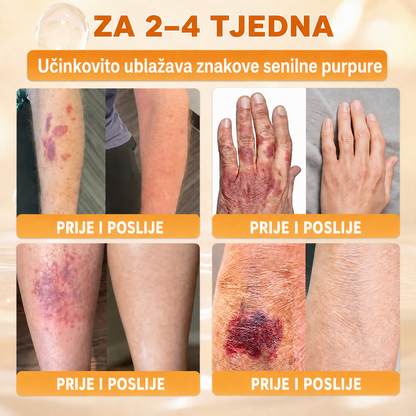 🔥🔥𝐒𝐥𝐮ž𝐛𝐞𝐧𝐚 𝐭𝐫𝐠𝐨𝐯𝐢𝐧𝐚 • 𝐏𝐫𝐨𝐢𝐳𝐯𝐞𝐝𝐞𝐧𝐨 𝐮 𝐇𝐫𝐯𝐚𝐭𝐬𝐤𝐨𝐣 👑𝗗𝗼𝗿𝗺𝗼𝗿𝗻𝗮® 𝗣č𝗲𝗹𝗶𝗻𝗷𝗶 𝗼𝘁𝗿𝗼𝘃 𝗖𝗷𝗲𝗹𝗼𝘃𝗶𝘁𝗮 𝗸𝗿𝗲𝗺𝗮🌟𝐏𝐎𝐒𝐋𝐉𝐄𝐃𝐍𝐉𝐈 𝐃𝐀𝐍 – 𝟖𝟎 % 𝐏𝐎𝐏𝐔𝐒𝐓𝐀