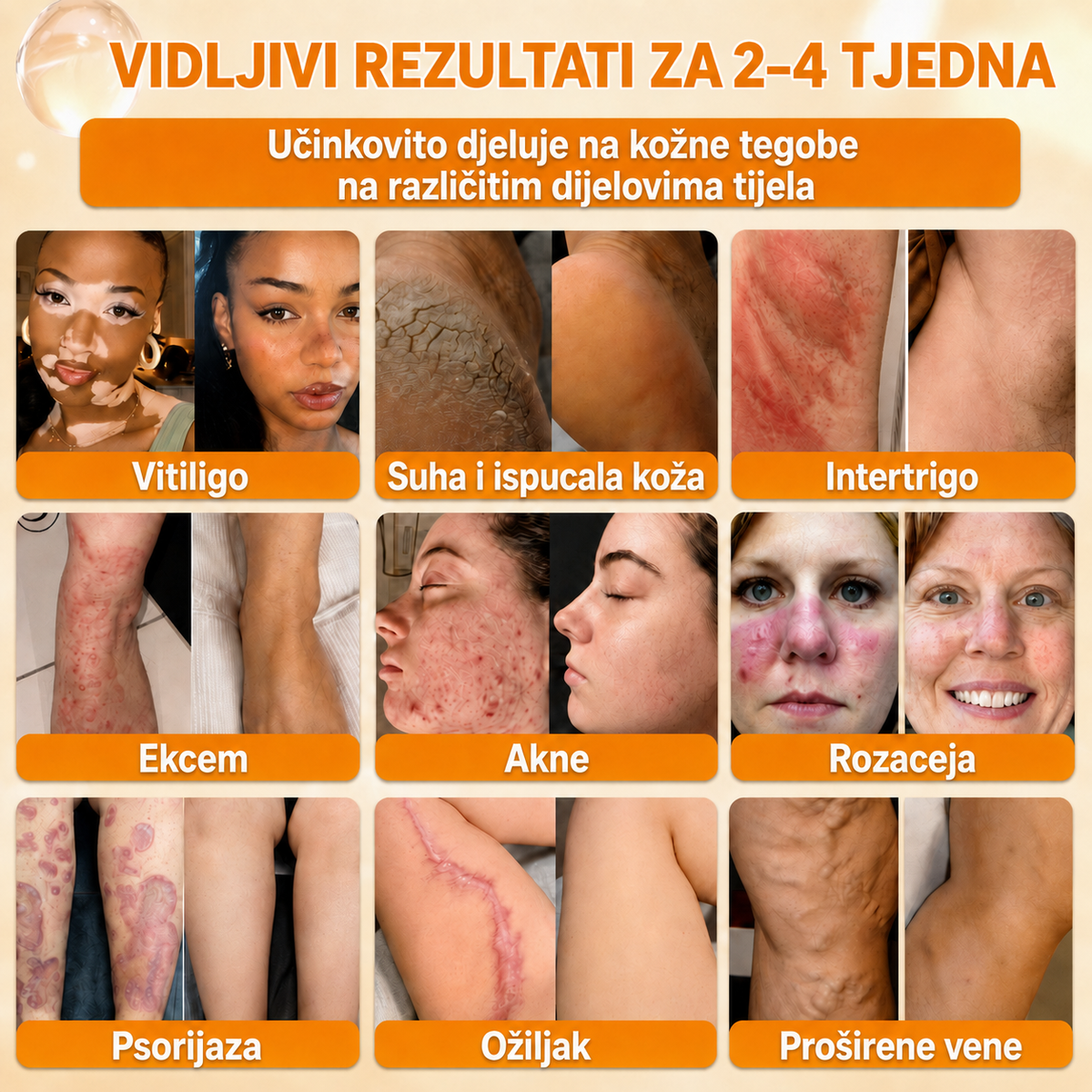 🔥🔥𝐒𝐥𝐮ž𝐛𝐞𝐧𝐚 𝐭𝐫𝐠𝐨𝐯𝐢𝐧𝐚 • 𝐏𝐫𝐨𝐢𝐳𝐯𝐞𝐝𝐞𝐧𝐨 𝐮 𝐇𝐫𝐯𝐚𝐭𝐬𝐤𝐨𝐣 👑𝗗𝗼𝗿𝗺𝗼𝗿𝗻𝗮® 𝗣č𝗲𝗹𝗶𝗻𝗷𝗶 𝗼𝘁𝗿𝗼𝘃 𝗖𝗷𝗲𝗹𝗼𝘃𝗶𝘁𝗮 𝗸𝗿𝗲𝗺𝗮🌟𝐏𝐎𝐒𝐋𝐉𝐄𝐃𝐍𝐉𝐈 𝐃𝐀𝐍 – 𝟖𝟎 % 𝐏𝐎𝐏𝐔𝐒𝐓𝐀