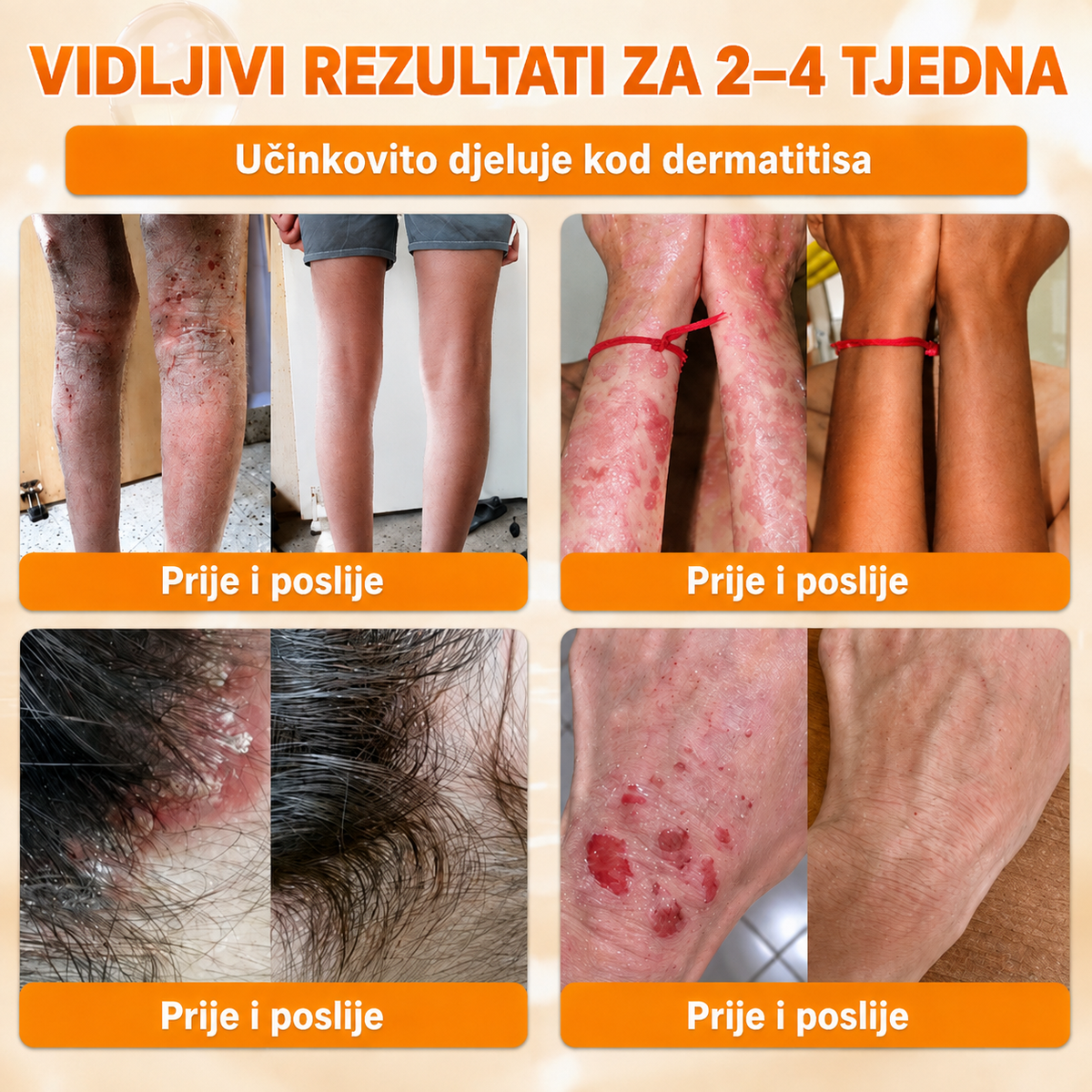 🔥🔥𝐒𝐥𝐮ž𝐛𝐞𝐧𝐚 𝐭𝐫𝐠𝐨𝐯𝐢𝐧𝐚 • 𝐏𝐫𝐨𝐢𝐳𝐯𝐞𝐝𝐞𝐧𝐨 𝐮 𝐇𝐫𝐯𝐚𝐭𝐬𝐤𝐨𝐣 👑𝗗𝗼𝗿𝗺𝗼𝗿𝗻𝗮® 𝗣č𝗲𝗹𝗶𝗻𝗷𝗶 𝗼𝘁𝗿𝗼𝘃 𝗖𝗷𝗲𝗹𝗼𝘃𝗶𝘁𝗮 𝗸𝗿𝗲𝗺𝗮🌟𝐏𝐎𝐒𝐋𝐉𝐄𝐃𝐍𝐉𝐈 𝐃𝐀𝐍 – 𝟖𝟎 % 𝐏𝐎𝐏𝐔𝐒𝐓𝐀