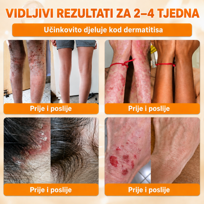 🔥🔥𝐒𝐥𝐮ž𝐛𝐞𝐧𝐚 𝐭𝐫𝐠𝐨𝐯𝐢𝐧𝐚 • 𝐏𝐫𝐨𝐢𝐳𝐯𝐞𝐝𝐞𝐧𝐨 𝐮 𝐇𝐫𝐯𝐚𝐭𝐬𝐤𝐨𝐣 👑𝗗𝗼𝗿𝗺𝗼𝗿𝗻𝗮® 𝗣č𝗲𝗹𝗶𝗻𝗷𝗶 𝗼𝘁𝗿𝗼𝘃 𝗖𝗷𝗲𝗹𝗼𝘃𝗶𝘁𝗮 𝗸𝗿𝗲𝗺𝗮🌟𝐏𝐎𝐒𝐋𝐉𝐄𝐃𝐍𝐉𝐈 𝐃𝐀𝐍 – 𝟖𝟎 % 𝐏𝐎𝐏𝐔𝐒𝐓𝐀