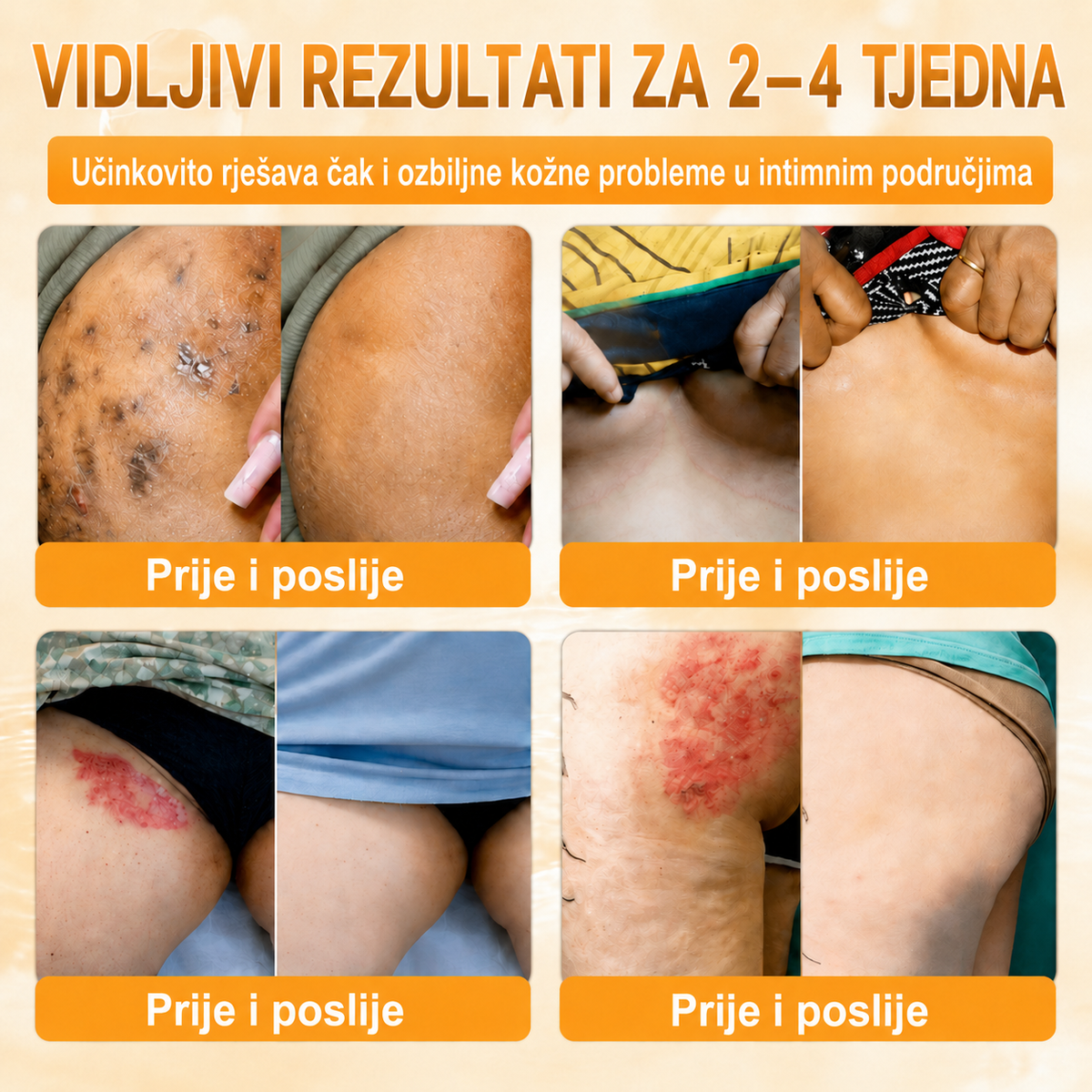 🔥🔥𝐒𝐥𝐮ž𝐛𝐞𝐧𝐚 𝐭𝐫𝐠𝐨𝐯𝐢𝐧𝐚 • 𝐏𝐫𝐨𝐢𝐳𝐯𝐞𝐝𝐞𝐧𝐨 𝐮 𝐇𝐫𝐯𝐚𝐭𝐬𝐤𝐨𝐣 👑𝗗𝗼𝗿𝗺𝗼𝗿𝗻𝗮® 𝗣č𝗲𝗹𝗶𝗻𝗷𝗶 𝗼𝘁𝗿𝗼𝘃 𝗖𝗷𝗲𝗹𝗼𝘃𝗶𝘁𝗮 𝗸𝗿𝗲𝗺𝗮🌟𝐏𝐎𝐒𝐋𝐉𝐄𝐃𝐍𝐉𝐈 𝐃𝐀𝐍 – 𝟖𝟎 % 𝐏𝐎𝐏𝐔𝐒𝐓𝐀