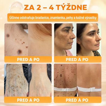 斯洛伐克🔥🔥𝐎𝐟𝐢𝐜𝐢á𝐥𝐧í 𝐨𝐛𝐜𝐡𝐨𝐝 • 𝐕𝐲𝐫𝐨𝐛𝐞𝐧𝐨 𝐯 Č𝐞𝐬𝐤é 𝐫𝐞𝐩𝐮𝐛𝐥𝐢𝐜𝐞 👑𝗗𝐨𝐫𝗺𝐨𝐫𝗻𝗮® 𝗩č𝗲𝗹í 𝗷𝗲𝗱 𝗞𝗼𝗺𝗽𝗹𝗲𝘅𝗻í 𝗸𝗿é𝗺 🌟𝐏𝐎𝐒𝐋𝐄𝐃𝐍Í 𝐃𝐄𝐍 – 𝟖𝟎 % 𝐒𝐋𝐄𝐕𝐀（副本）