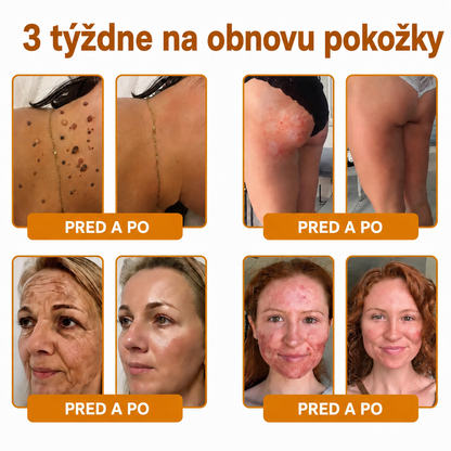 斯洛伐克🔥🔥𝐎𝐟𝐢𝐜𝐢á𝐥𝐧í 𝐨𝐛𝐜𝐡𝐨𝐝 • 𝐕𝐲𝐫𝐨𝐛𝐞𝐧𝐨 𝐯 Č𝐞𝐬𝐤é 𝐫𝐞𝐩𝐮𝐛𝐥𝐢𝐜𝐞 👑𝗗𝐨𝐫𝗺𝐨𝐫𝗻𝗮® 𝗩č𝗲𝗹í 𝗷𝗲𝗱 𝗞𝗼𝗺𝗽𝗹𝗲𝘅𝗻í 𝗸𝗿é𝗺 🌟𝐏𝐎𝐒𝐋𝐄𝐃𝐍Í 𝐃𝐄𝐍 – 𝟖𝟎 % 𝐒𝐋𝐄𝐕𝐀（副本）