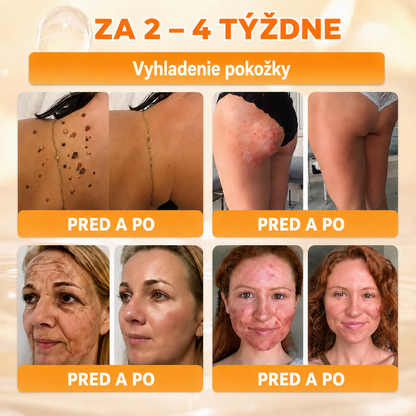 斯洛伐克🔥🔥𝐎𝐟𝐢𝐜𝐢á𝐥𝐧í 𝐨𝐛𝐜𝐡𝐨𝐝 • 𝐕𝐲𝐫𝐨𝐛𝐞𝐧𝐨 𝐯 Č𝐞𝐬𝐤é 𝐫𝐞𝐩𝐮𝐛𝐥𝐢𝐜𝐞 👑𝗗𝐨𝐫𝗺𝐨𝐫𝗻𝗮® 𝗩č𝗲𝗹í 𝗷𝗲𝗱 𝗞𝗼𝗺𝗽𝗹𝗲𝘅𝗻í 𝗸𝗿é𝗺 🌟𝐏𝐎𝐒𝐋𝐄𝐃𝐍Í 𝐃𝐄𝐍 – 𝟖𝟎 % 𝐒𝐋𝐄𝐕𝐀（副本）