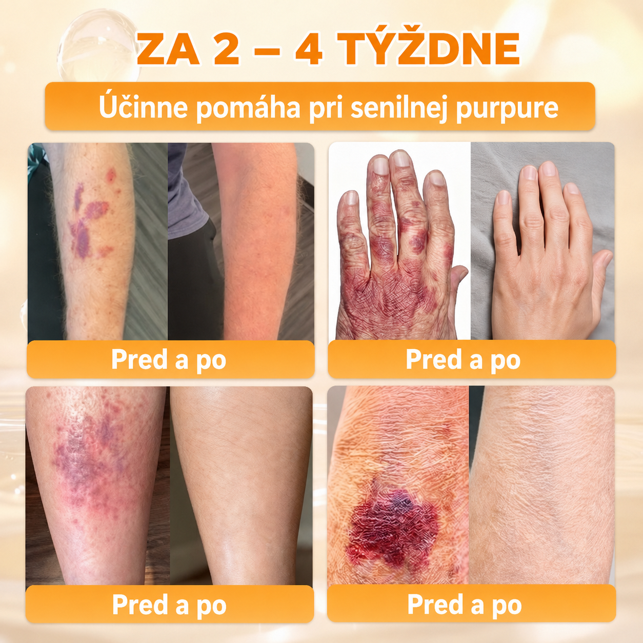 斯洛伐克🔥🔥𝐎𝐟𝐢𝐜𝐢á𝐥𝐧í 𝐨𝐛𝐜𝐡𝐨𝐝 • 𝐕𝐲𝐫𝐨𝐛𝐞𝐧𝐨 𝐯 Č𝐞𝐬𝐤é 𝐫𝐞𝐩𝐮𝐛𝐥𝐢𝐜𝐞 👑𝗗𝐨𝐫𝗺𝐨𝐫𝗻𝗮® 𝗩č𝗲𝗹í 𝗷𝗲𝗱 𝗞𝗼𝗺𝗽𝗹𝗲𝘅𝗻í 𝗸𝗿é𝗺 🌟𝐏𝐎𝐒𝐋𝐄𝐃𝐍Í 𝐃𝐄𝐍 – 𝟖𝟎 % 𝐒𝐋𝐄𝐕𝐀（副本）