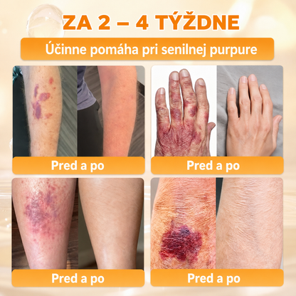 斯洛伐克🔥🔥𝐎𝐟𝐢𝐜𝐢á𝐥𝐧í 𝐨𝐛𝐜𝐡𝐨𝐝 • 𝐕𝐲𝐫𝐨𝐛𝐞𝐧𝐨 𝐯 Č𝐞𝐬𝐤é 𝐫𝐞𝐩𝐮𝐛𝐥𝐢𝐜𝐞 👑𝗗𝐨𝐫𝗺𝐨𝐫𝗻𝗮® 𝗩č𝗲𝗹í 𝗷𝗲𝗱 𝗞𝗼𝗺𝗽𝗹𝗲𝘅𝗻í 𝗸𝗿é𝗺 🌟𝐏𝐎𝐒𝐋𝐄𝐃𝐍Í 𝐃𝐄𝐍 – 𝟖𝟎 % 𝐒𝐋𝐄𝐕𝐀（副本）