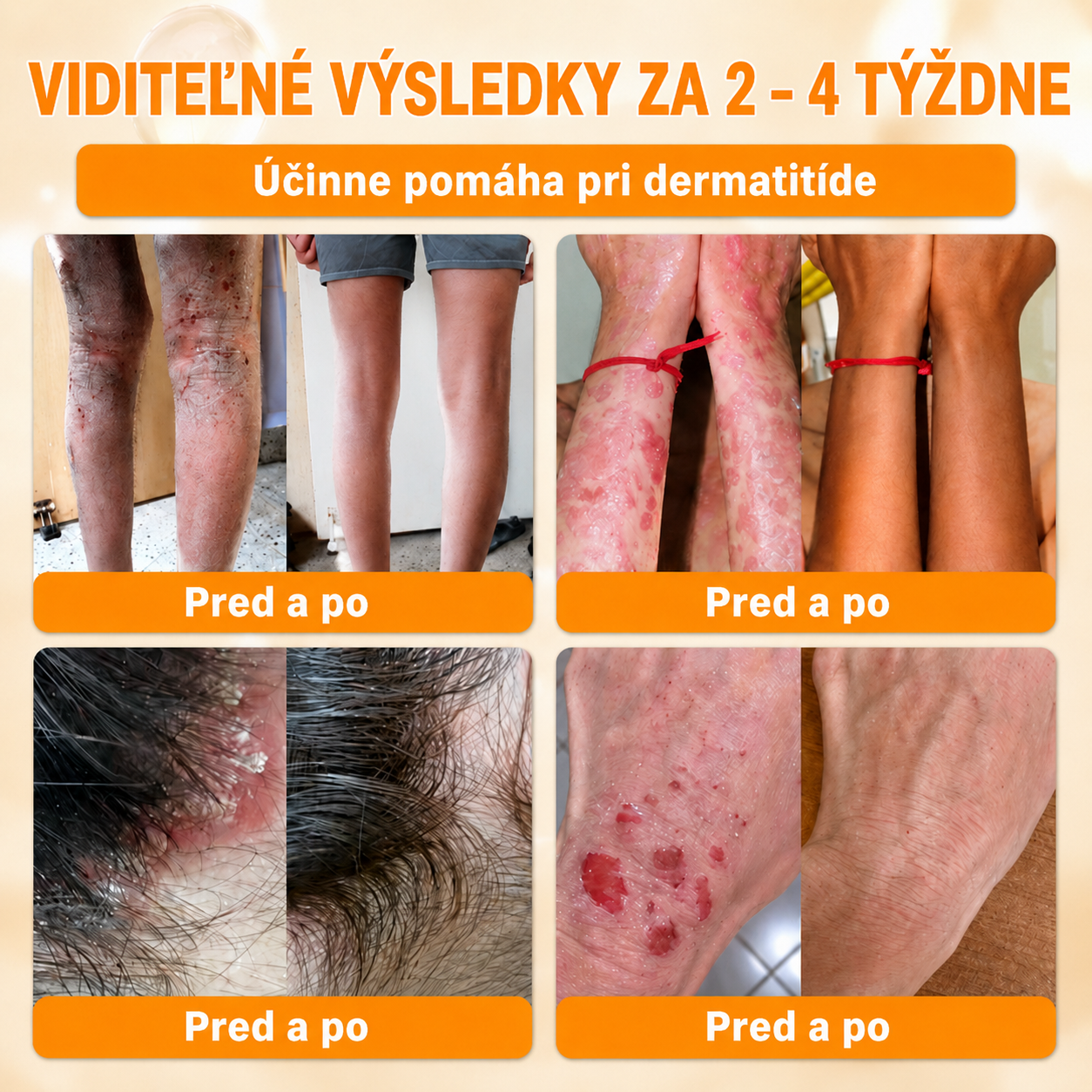 斯洛伐克🔥🔥𝐎𝐟𝐢𝐜𝐢á𝐥𝐧í 𝐨𝐛𝐜𝐡𝐨𝐝 • 𝐕𝐲𝐫𝐨𝐛𝐞𝐧𝐨 𝐯 Č𝐞𝐬𝐤é 𝐫𝐞𝐩𝐮𝐛𝐥𝐢𝐜𝐞 👑𝗗𝐨𝐫𝗺𝐨𝐫𝗻𝗮® 𝗩č𝗲𝗹í 𝗷𝗲𝗱 𝗞𝗼𝗺𝗽𝗹𝗲𝘅𝗻í 𝗸𝗿é𝗺 🌟𝐏𝐎𝐒𝐋𝐄𝐃𝐍Í 𝐃𝐄𝐍 – 𝟖𝟎 % 𝐒𝐋𝐄𝐕𝐀（副本）
